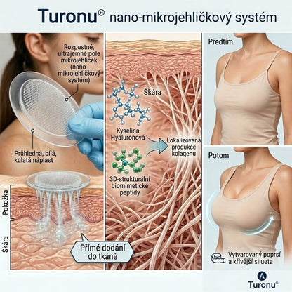 💥Turonu® 👨‍🔬Pokročilé nano-mikroihlové náplasti na cielené tvarování poprsia💃