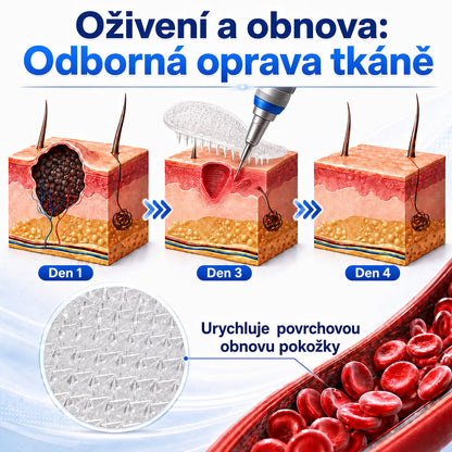 👩‍⚕️💕 Oficiální obchod | 𝑵𝐞𝒌𝐢𝐬𝐬® 🌿  Botanická hydrokoloidní náplast s mikrojehličkami (pro kožní výrůstky, drobné kožní výrůstky, bradavice, mateřská znaménka, stařecké skvrny a problémy s pigmentací)