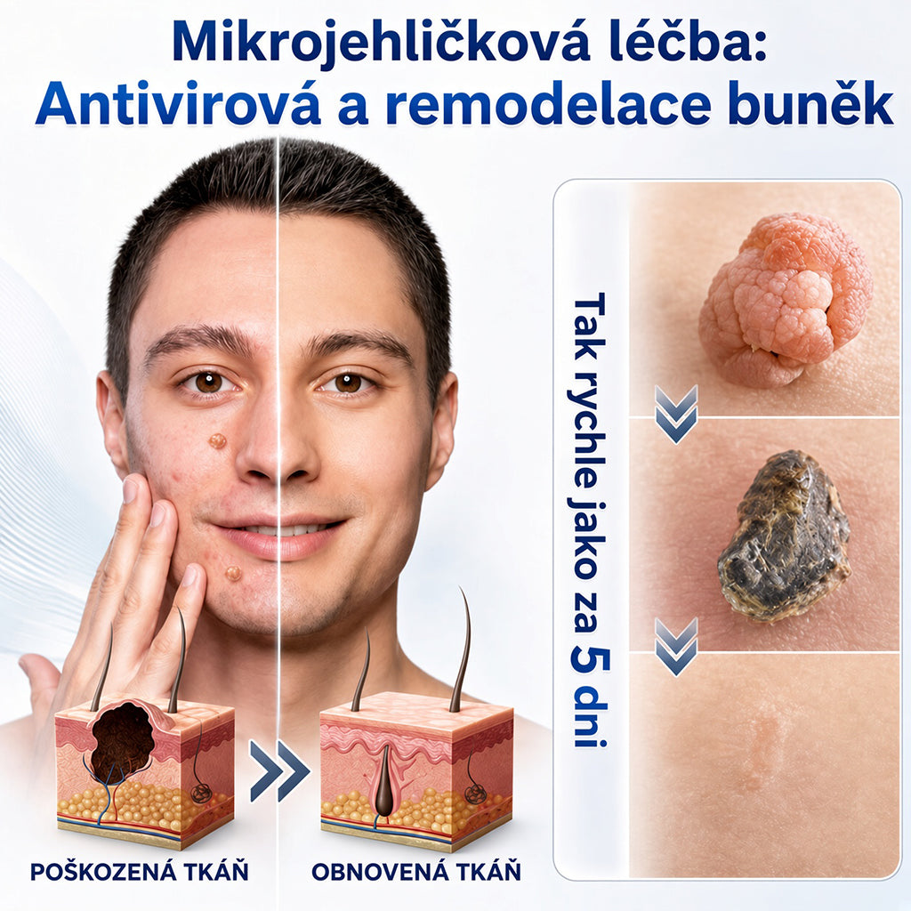 👩‍⚕️💕 Oficiální obchod | 𝑵𝐞𝒌𝐢𝐬𝐬® 🌿  Botanická hydrokoloidní náplast s mikrojehličkami (pro kožní výrůstky, drobné kožní výrůstky, bradavice, mateřská znaménka, stařecké skvrny a problémy s pigmentací)