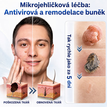 👩‍⚕️💕 Oficiální obchod | 𝑵𝐞𝒌𝐢𝐬𝐬® 🌿  Botanická hydrokoloidní náplast s mikrojehličkami (pro kožní výrůstky, drobné kožní výrůstky, bradavice, mateřská znaménka, stařecké skvrny a problémy s pigmentací)