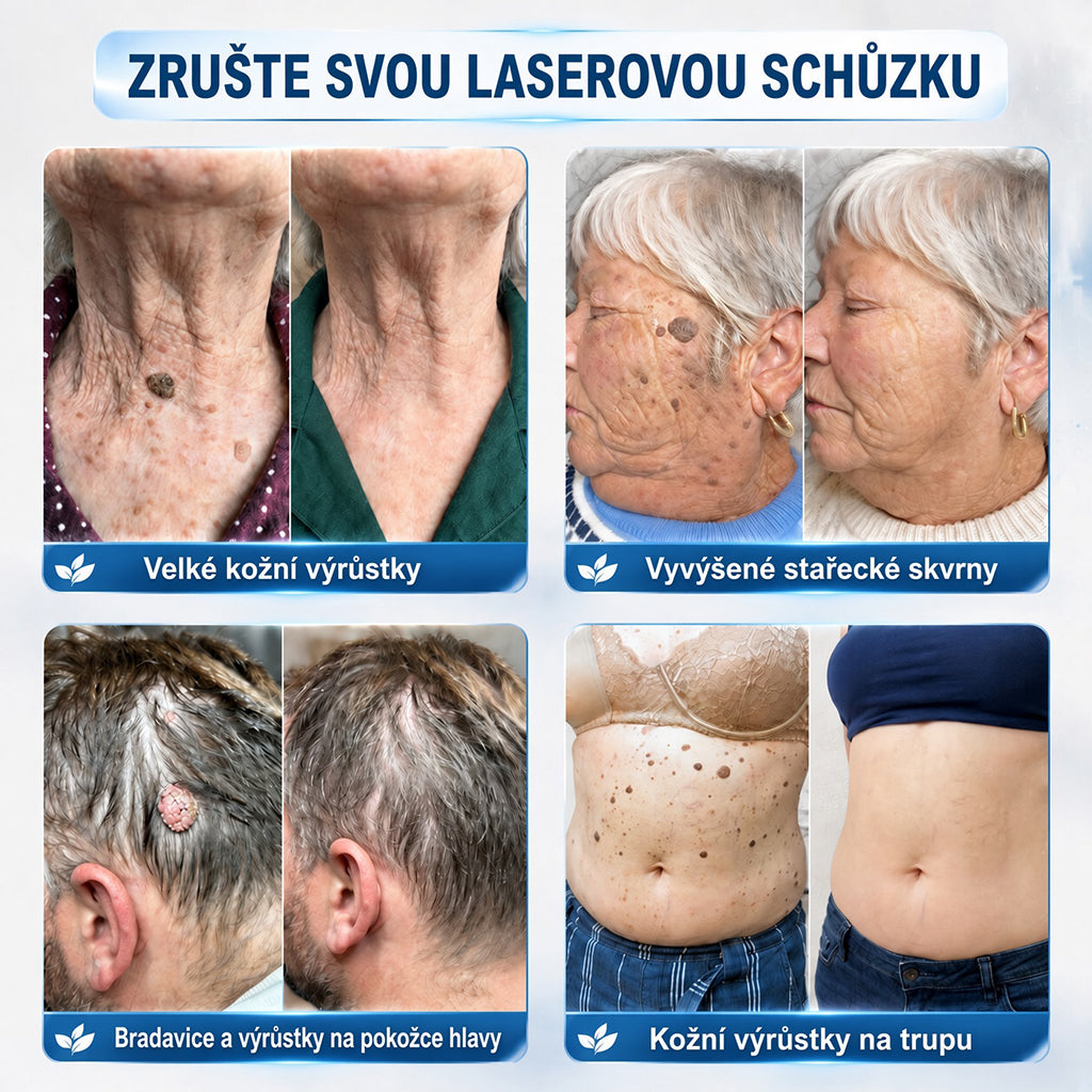 👩‍⚕️💕 Oficiální obchod | 𝑵𝐞𝒌𝐢𝐬𝐬® 🌿  Botanická hydrokoloidní náplast s mikrojehličkami (pro kožní výrůstky, drobné kožní výrůstky, bradavice, mateřská znaménka, stařecké skvrny a problémy s pigmentací)