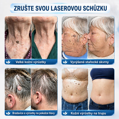 👩‍⚕️💕 Oficiální obchod | 𝑵𝐞𝒌𝐢𝐬𝐬® 🌿  Botanická hydrokoloidní náplast s mikrojehličkami (pro kožní výrůstky, drobné kožní výrůstky, bradavice, mateřská znaménka, stařecké skvrny a problémy s pigmentací)