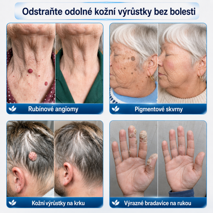 Oficiální obchod značky👨‍🔬Trilumia® 7denní odstraňovač kožních výrůstků a pigmentových skvrn (Bez bolesti, bez jizev – Roll-on)-01