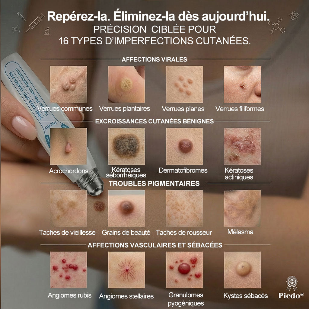 Oficiální obchod značky👨‍🔬𝐏𝐢𝐜𝐝𝐨® 7denní odstraňovač kožních výrůstků a pigmentových skvrn (Bez bolesti, bez jizev – Roll-on)