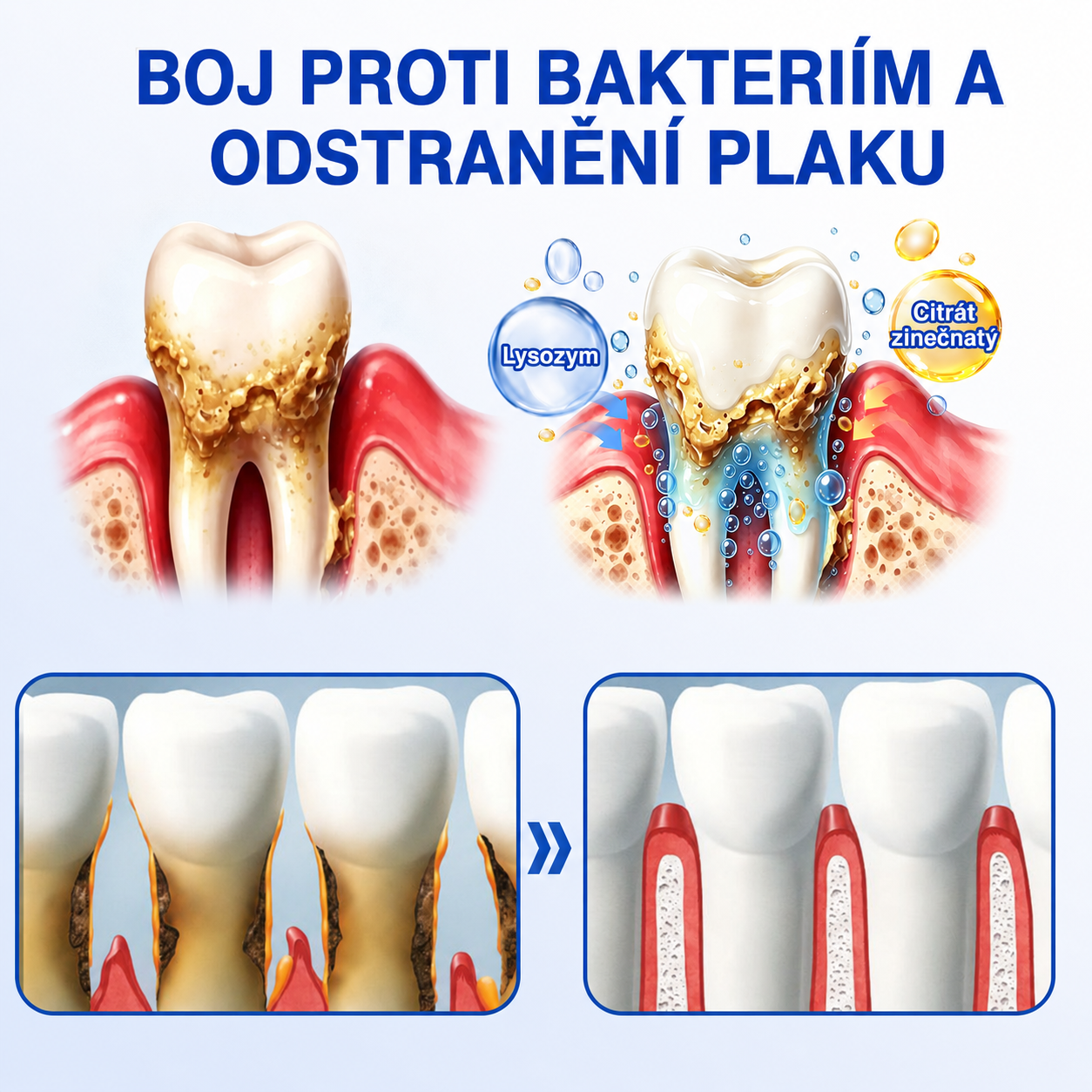 🇨🇿 HEATWOLF® 🦷 GumRevive parodontální opravný gel 🍕
