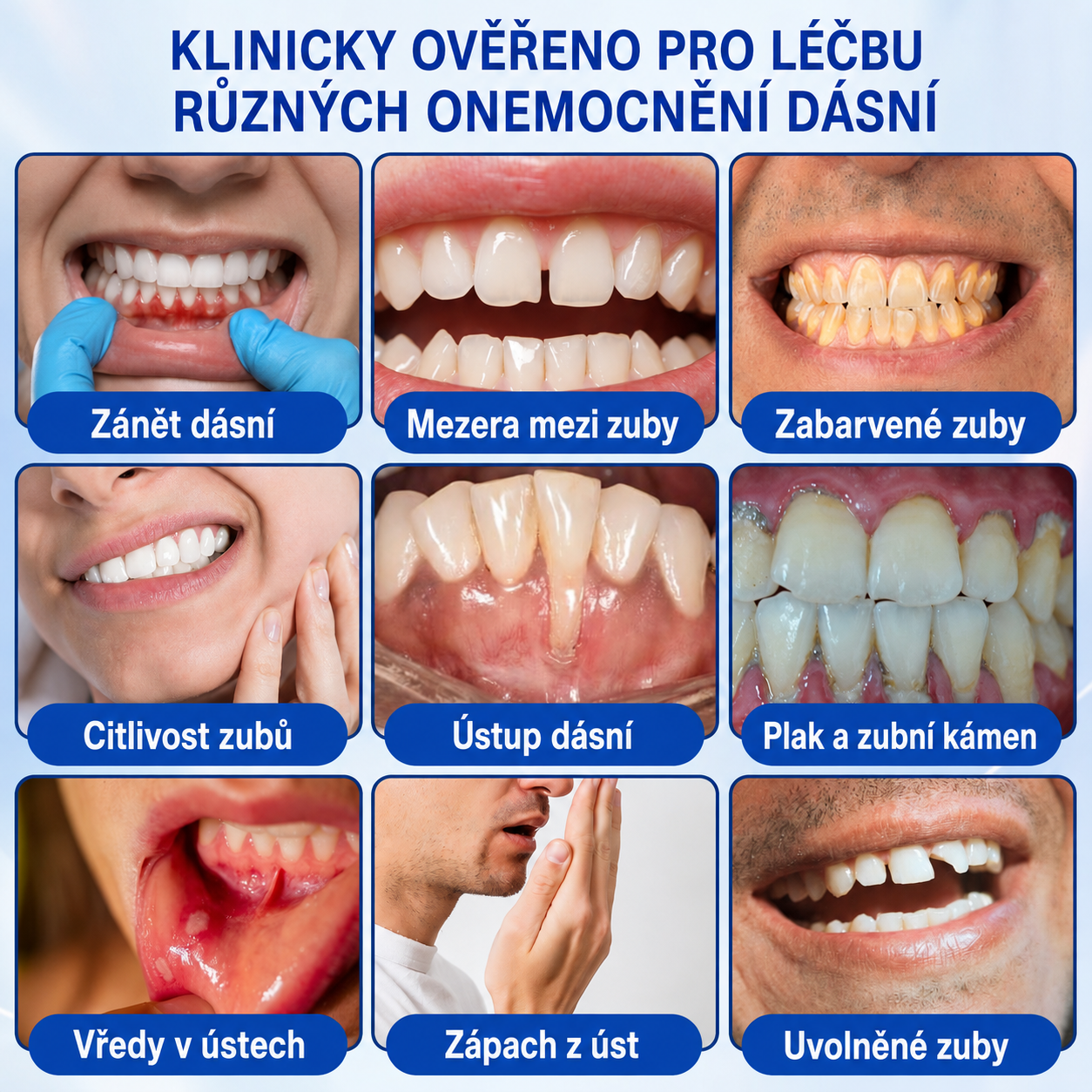 🇨🇿 HEATWOLF® 🦷 GumRevive parodontální opravný gel 🍕