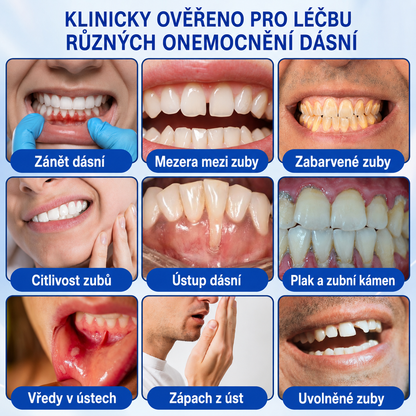 🇨🇿 HEATWOLF® 🦷 GumRevive parodontální opravný gel 🍕