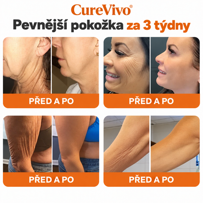 🔥Oficiální obchod značky 丨 CureVivo® Včelí Jed Pro Comprehensive Cream