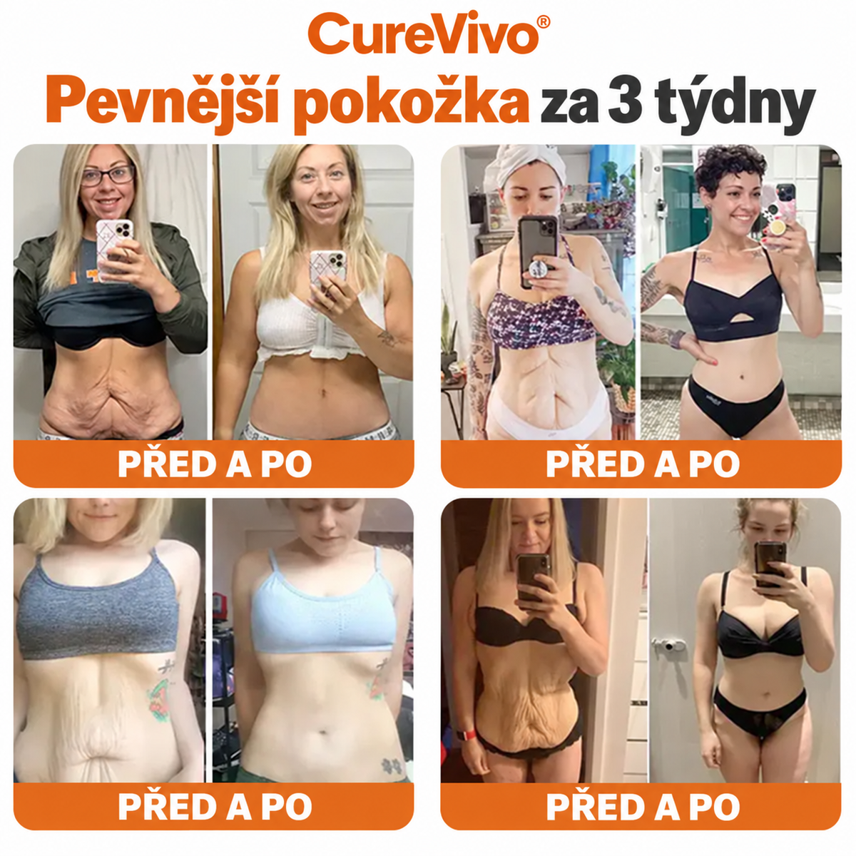 🔥Oficiální obchod značky 丨 CureVivo® Včelí Jed Pro Comprehensive Cream