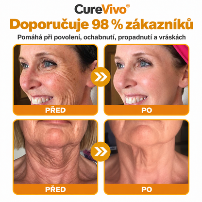 🔥Oficiální obchod značky 丨 CureVivo® Včelí Jed Pro Comprehensive Cream