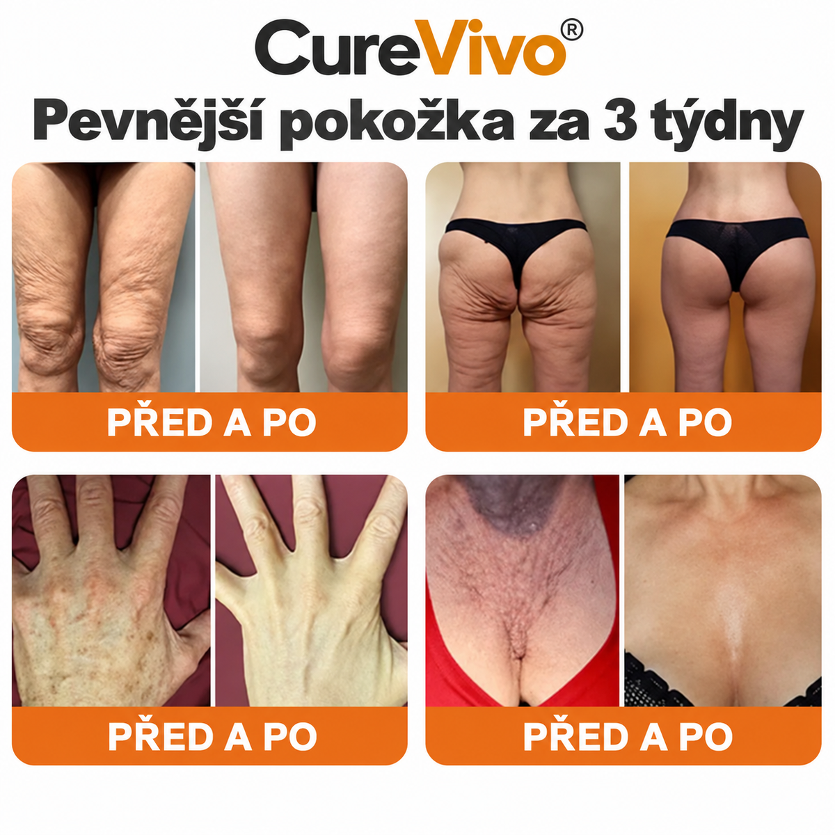 🔥Oficiální obchod značky 丨 CureVivo® Včelí Jed Pro Comprehensive Cream