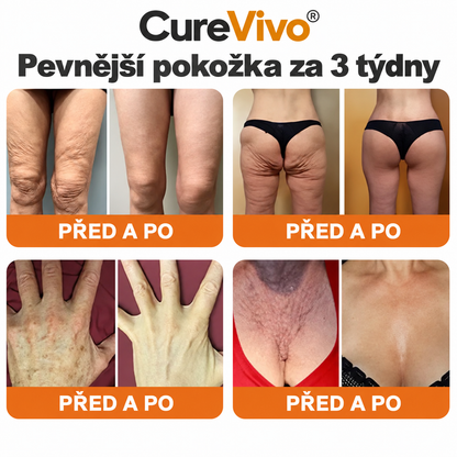 🔥Oficiální obchod značky 丨 CureVivo® Včelí Jed Pro Comprehensive Cream
